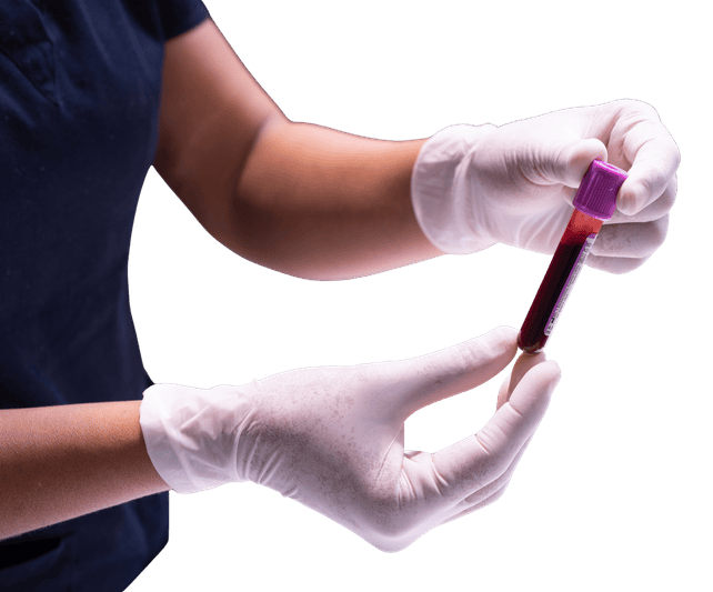 Tubo de recolección